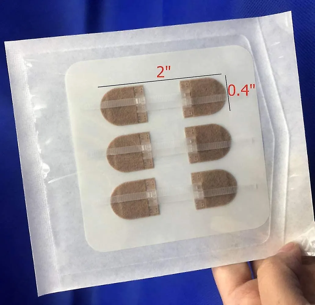 EMERGENCY WOUND CLOSURES BANDAID ADHESIVE BANDAGES, ZIP STITCH STICKERS FOR CAMPING, SURVIVAL & HOUSEHOLD GEAR, 3 PCS (45*1